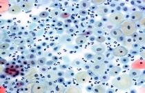 Smear test after chilldbirth