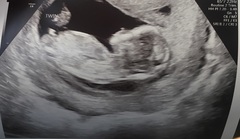 Gender guess anyone??