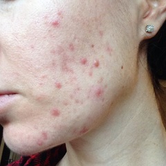 Yet More Fantastic Skincare and Where To Find It