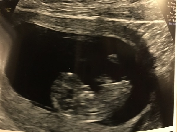 Staying posifrickentive- Thread 14 for ladies pg after mc