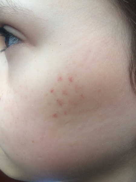 What could this rash be?