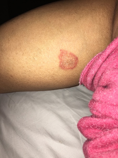 What IS this on my leg? (Pic)