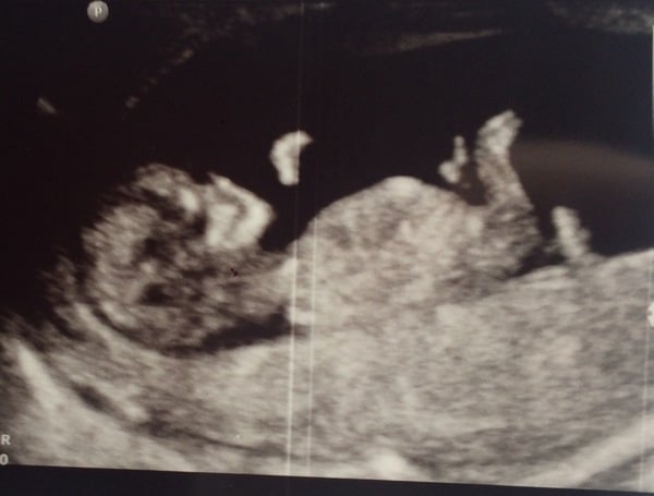 August 2017: the one in which we'll get midwife appointment