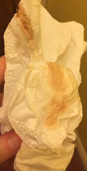 Does anyone know what implantation bleeding is like?