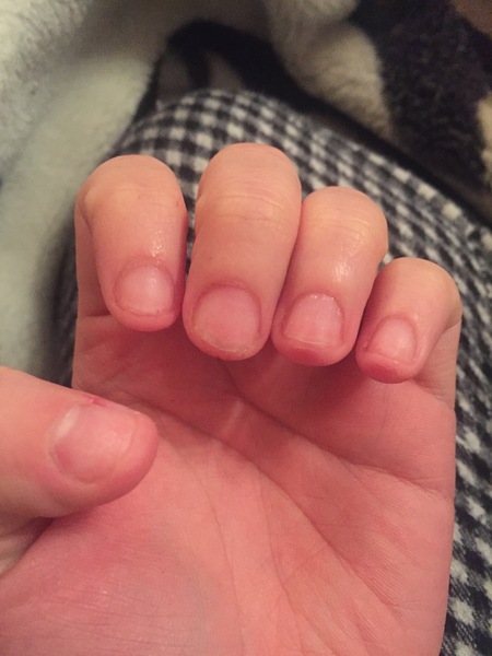 Nail help needed