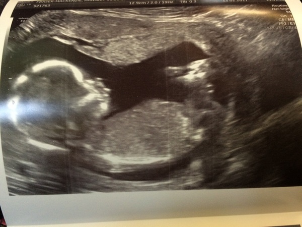 August 2017: the one in which we'll get midwife appointment