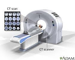 Brain CT