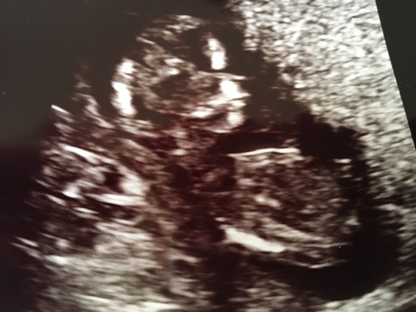 #TTC1 - Second Wave grads thread!