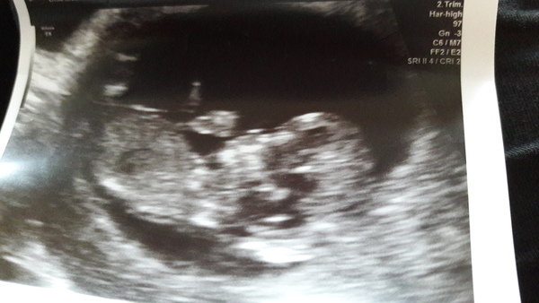 August 2017: the one in which we'll get midwife appointment