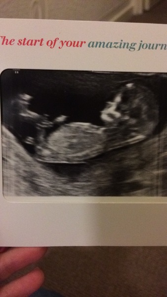 August 2017: the one in which we'll get midwife appointment