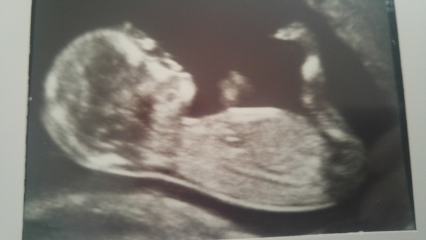 Gender guesses?