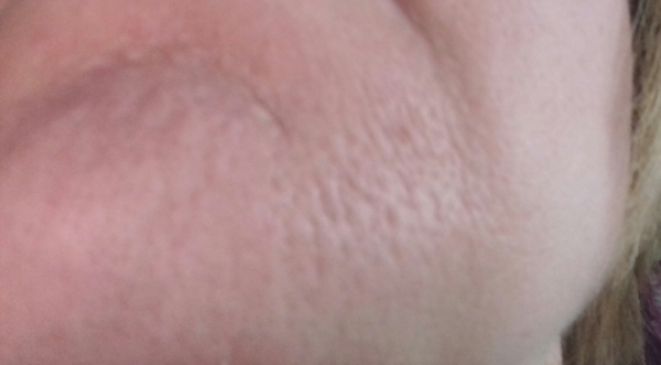Skin Help