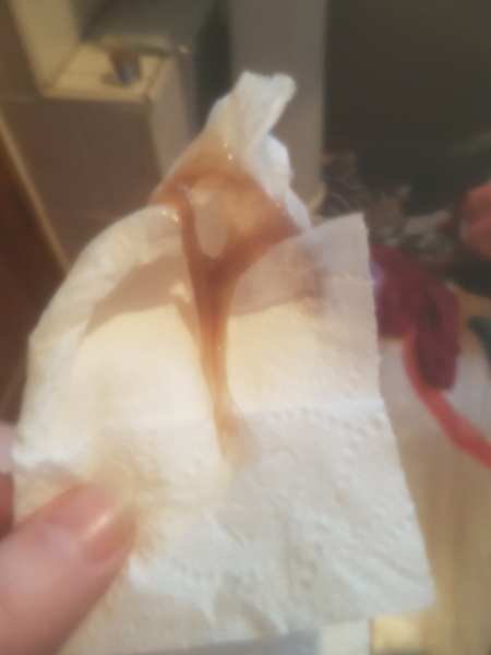 Ttc after miscarriage thread #8