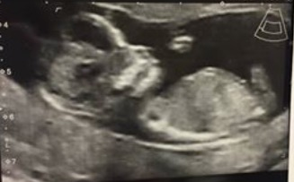 Boy or girl? Xx