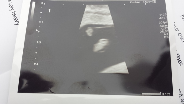 Staying posifrickentive- Thread 14 for ladies pg after mc