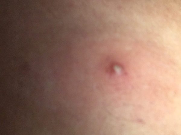 Sound the klaxon he's going to blow!