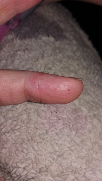 What's this on my finger. Rubbish pic.