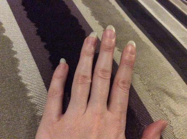 Nail help needed