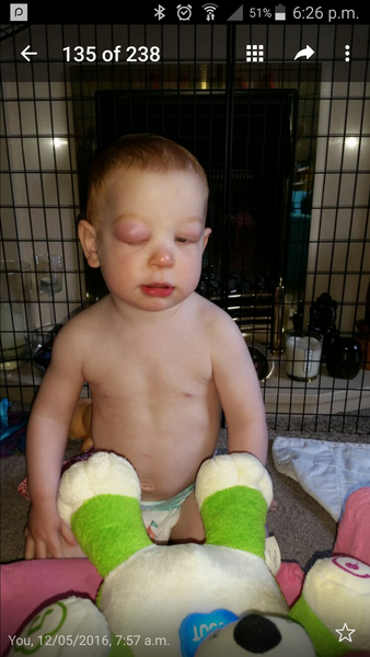 Could this be cellulitis (photo)?