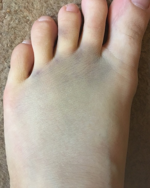 I've done something really weird to my foot