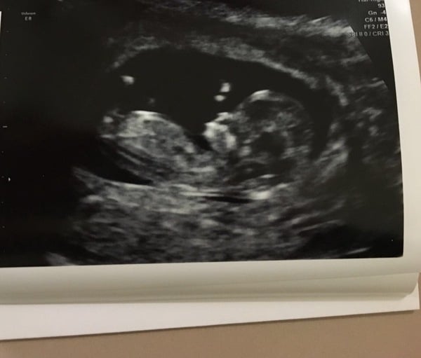 #TTC1 - Second Wave grads thread!