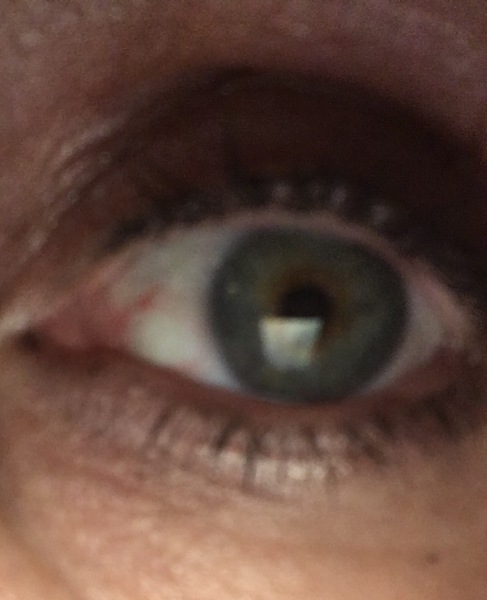 To think I have grey coloured eyes and not blue (pic included)