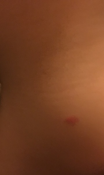 Red mark on dd