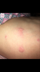 Weird lumps appearing on DP?!