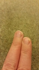 What's wrong with my nails?