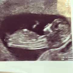 12+4 week scan - nub / skull guesses x