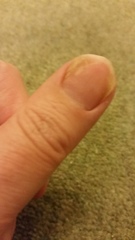 What's wrong with my nails?