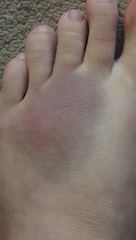 I've done something really weird to my foot