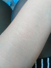 To ask if you'd judge someone if they had obviously self harm scars?