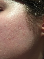 Ditch The Foundation, Embrace Some Fantastic Skincare Instead!