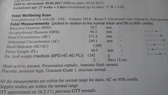 May 2017 #7....... Final months, rapidly growing bumps