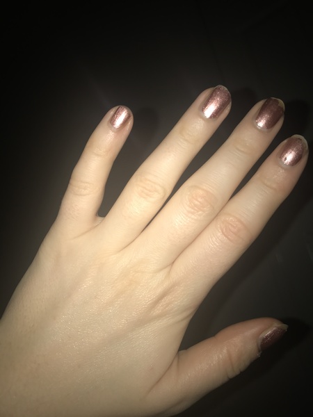 Guess the age of my hand.