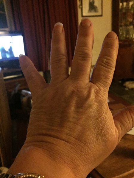 Guess the age of my hand.