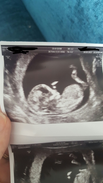 October Babies No. 3