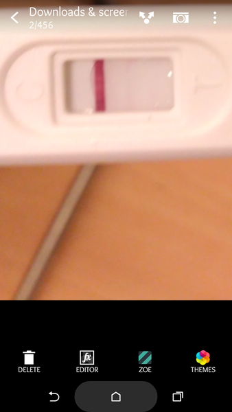 Am I pregnant or do I have line eyes ??