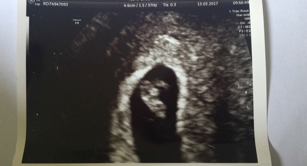 Getting Ready For Baby Challenge Thread 5