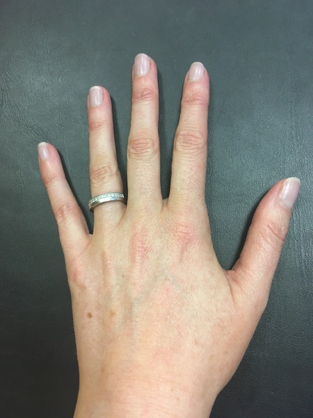 Guess the age of my hand.