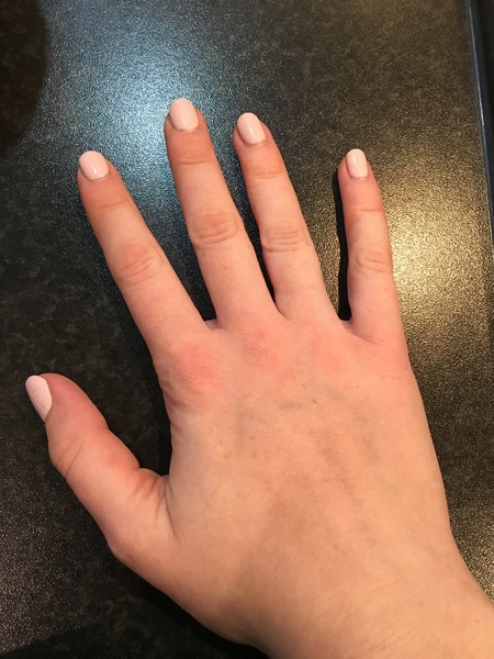 Guess the age of my hand.