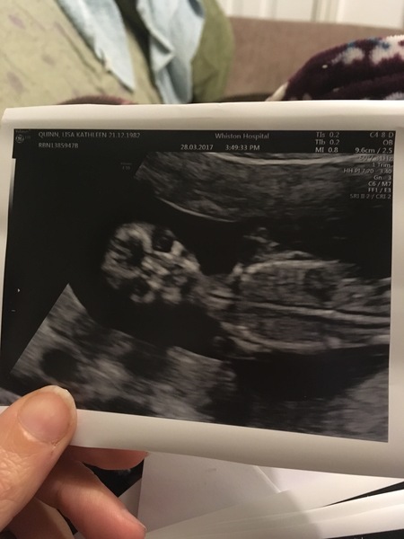 October Babies No. 3