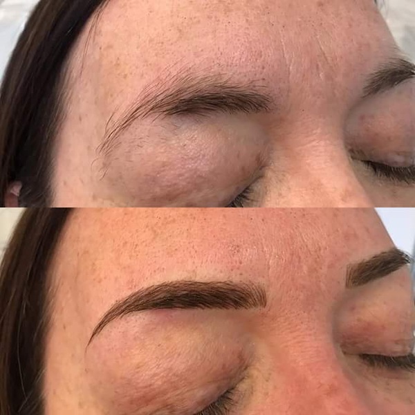 over plucked brows