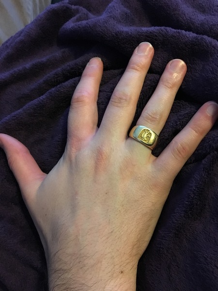 Guess the age of my hand.