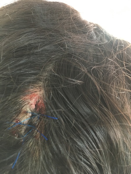 *klaxon* Sporn advice needed