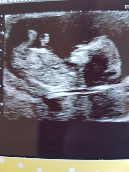Can anyone guess boy or girl?