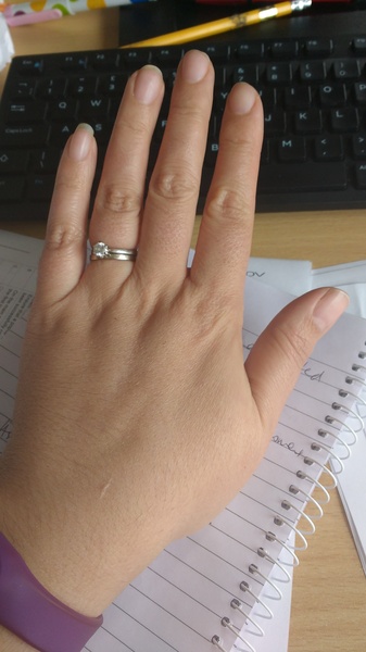 Guess the age of my hand.
