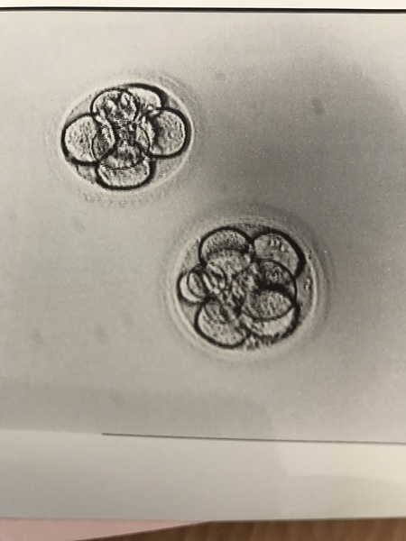 #makeithappen TTC through Donor IUI or Donor IVF or just undecided – all welcome!  Thread #6