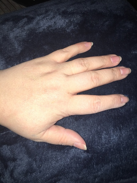 Guess the age of my hand.